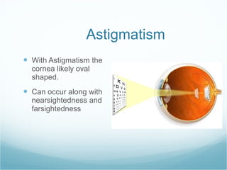 Astigmatism With Astigmatism the cornea likely oval shaped. Can occur along with nearsightedness and farsightedness 