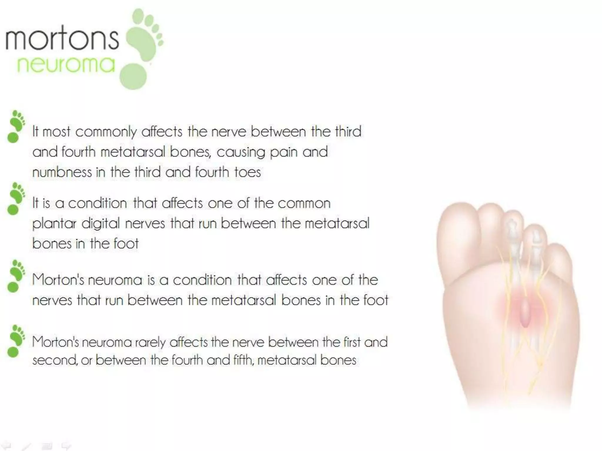 12 Major Foot Problems And Solutions