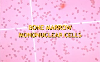 BONE MARROWBONE MARROW
MONONUCLEAR CELLSMONONUCLEAR CELLS
 
