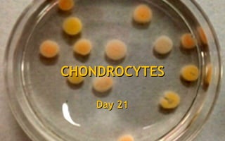 Day 3Day 3Day 5Day 5Day 7Day 7Day 21Day 21
CHONDROCYTESCHONDROCYTES
 