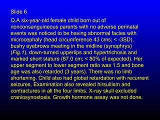 Slide 6
Q.A six-year-old female child born out of
nonconsanguineous parents with no adverse perinatal
events was noticed to be having abnormal facies with
microcephaly (head circumference 43 cms; < -3SD),
bushy eyebrows meeting in the midline (synophrys)
(Fig.1), down-turned upperlips and hypertrichosis and
marked short stature (87.0 cm; < 80% of expected). Her
upper segment to lower segment ratio was 1.5 and bone
age was also retarded (3 years). There was no limb
shortening. Child also had global retardation with recurrent
seizures. Examination also revealed hirsuitism and
contractures in all the four limbs. X-ray skull excluded
craniosynostosis. Growth hormone assay was not done.
 