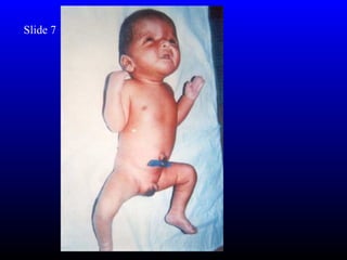 Slide 7
 