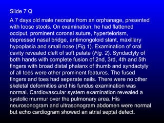 Slide 7 Q
A 7 days old male neonate from an orphanage, presented
with loose stools. On examination, he had flattened
occiput, prominent coronal suture, hypertelorism,
depressed nasal bridge, antimongoloid slant, maxillary
hypoplasia and small nose (Fig.1). Examination of oral
cavity revealed cleft of soft palate (Fig. 2). Syndactyly of
both hands with complete fusion of 2nd, 3rd, 4th and 5th
fingers with broad distal phalanx of thumb and syndactyly
of all toes were other prominent features. The fused
fingers and toes had separate nails. There were no other
skeletal deformities and his fundus examination was
normal. Cardiovascular system examination revealed a
systolic murmur over the pulmonary area. His
neurosonogram and ultrasonogram abdomen were normal
but echo cardiogram showed an atrial septal defect.
 