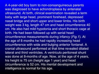 A 4-year-old boy born to non-consanguineous parents
was diagnosed to have achondroplasia by antenatal
ultrasound. At birth, clinical examination revealed a term
baby with large head, prominent forehead, depressed
nasal bridge and short upper and lower limbs. His birth
weight was 3 kg, length 47 cm and head circumference 40
cm. He also had mild hypotonia and short thoracic cage at
birth. He had been followed up with serial head
circumference measurements during infancy (Fig.1). At
the age of 8 months he had rapidly increasing head
circumference with wide and bulging anterior fontanel. A
cranial ultrasound performed at that time revealed dilated
lateral and third ventricles. A ventriculo peritoneal shunt
was done at 8-months of age. Now, at the age of 4 years,
his height is 75 cm (height age 1 year) and head
circumference is 52 cm. His mental development and
intelligence is normal for his age.
 