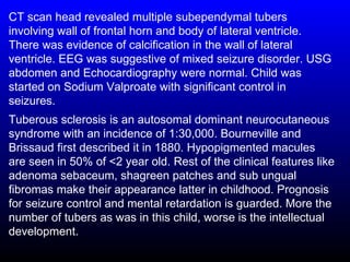 CT scan head revealed multiple subependymal tubers
involving wall of frontal horn and body of lateral ventricle.
There was evidence of calcification in the wall of lateral
ventricle. EEG was suggestive of mixed seizure disorder. USG
abdomen and Echocardiography were normal. Child was
started on Sodium Valproate with significant control in
seizures.
Tuberous sclerosis is an autosomal dominant neurocutaneous
syndrome with an incidence of 1:30,000. Bourneville and
Brissaud first described it in 1880. Hypopigmented macules
are seen in 50% of <2 year old. Rest of the clinical features like
adenoma sebaceum, shagreen patches and sub ungual
fibromas make their appearance latter in childhood. Prognosis
for seizure control and mental retardation is guarded. More the
number of tubers as was in this child, worse is the intellectual
development.
 