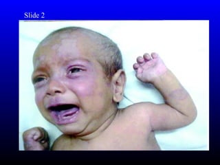 Slide 2
 