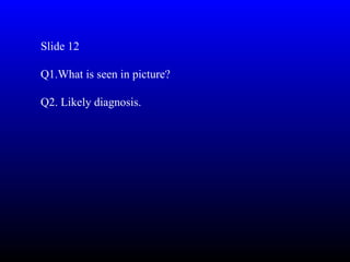 Slide 12

Q1.What is seen in picture?

Q2. Likely diagnosis.
 