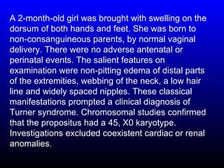 A 2-month-old girl was brought with swelling on the
dorsum of both hands and feet. She was born to
non-consanguineous parents, by normal vaginal
delivery. There were no adverse antenatal or
perinatal events. The salient features on
examination were non-pitting edema of distal parts
of the extremities, webbing of the neck, a low hair
line and widely spaced nipples. These classical
manifestations prompted a clinical diagnosis of
Turner syndrome. Chromosomal studies confirmed
that the propositus had a 45, X0 karyotype.
Investigations excluded coexistent cardiac or renal
anomalies.
 