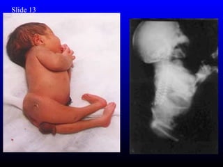 Slide 13
 