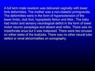 A full term male newborn was delivered vaginally with lower
limb deformities. The mother was a non-diabetic primigravida.
The deformities were in the form of hyperextension of the
lower limbs, club foot, hypoplastic femur and tibia . The baby
had motor and sensory neurological deficit in the form of lower
motor neuron paraplegia and absent anal reflex. There was no
imperforate anus but it was malposed. There were two sinuses
on either sides of the buttocks. There was no other neural tube
defect or renal abnormalities on sonography.
 