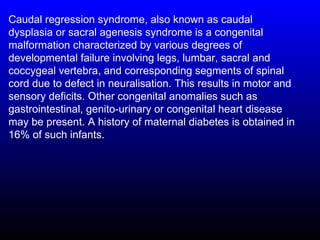 Caudal regression syndrome, also known as caudal
dysplasia or sacral agenesis syndrome is a congenital
malformation characterized by various degrees of
developmental failure involving legs, lumbar, sacral and
coccygeal vertebra, and corresponding segments of spinal
cord due to defect in neuralisation. This results in motor and
sensory deficits. Other congenital anomalies such as
gastrointestinal, genito-urinary or congenital heart disease
may be present. A history of maternal diabetes is obtained in
16% of such infants.
 