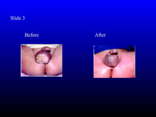 Slide 3


      Before   After
 