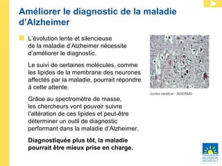 Améliorer le diagnostic de la maladie d’Alzheimer L’évolution lente et silencieuse  de la maladie d’Alzheimer nécessite  d’améliorer le diagnostic. Le suivi de certaines molécules, comme  les lipides de la membrane des neurones affectés par la maladie, pourrait répondre  à cette attente.  Grâce au spectromètre de masse,  les chercheurs vont pouvoir suivre l’altération de ces lipides et peut-être déterminer un outil de diagnostic performant dans la maladie d’Alzheimer.  Diagnostiquée plus tôt, la maladie pourrait être mieux prise en charge. Cortex cérébral - INSERM© 