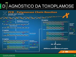 TOXOPLASMOSE
D AGNÓSTICO DA TOXOPLAMOSE
11
 