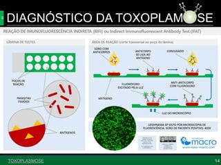 DIAGNÓSTICO DA TOXOPLAM SE
14TOXOPLASMOSE
 