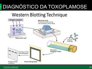 TOXOPLASMOSE
DIAGNÓSTICO DA TOXOPLAMOSE
20
 