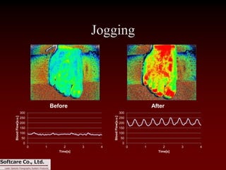 Introduction of Laser Speckle Flowgraphy LSFG-PFI | PDF