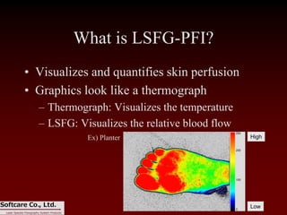 Introduction of Laser Speckle Flowgraphy LSFG-PFI | PDF