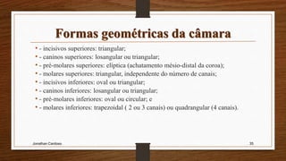 • - incisivos superiores: triangular;
• - caninos superiores: losangular ou triangular;
• - pré-molares superiores: elíptica (achatamento mésio-distal da coroa);
• - molares superiores: triangular, independente do número de canais;
• - incisivos inferiores: oval ou triangular;
• - caninos inferiores: losangular ou triangular;
• - pré-molares inferiores: oval ou circular; e
• - molares inferiores: trapezoidal ( 2 ou 3 canais) ou quadrangular (4 canais).
Jonathan Cardoso 35
 