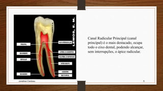 Jonathan Cardoso 5
Canal Radicular Principal (canal
principal) é o mais destacado, ocupa
todo o eixo dental, podendo alcançar,
sem interrupções, o ápice radicular.
 