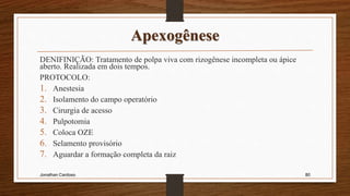 Apexogênese
DENIFINIÇÃO: Tratamento de polpa viva com rizogênese incompleta ou ápice
aberto. Realizada em dois tempos.
PROTOCOLO:
1. Anestesia
2. Isolamento do campo operatório
3. Cirurgia de acesso
4. Pulpotomia
5. Coloca OZE
6. Selamento provisório
7. Aguardar a formação completa da raiz
Jonathan Cardoso 80
 