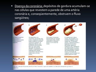 Doença da coronária: depósitos de gordura acumulam-se
  nas células que revestem a parede de uma artéria
  coronária e, conseqüentemente, obstruem o fluxo
  sangüíneo;
 