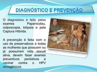 O diagnóstico é feito pelos
exames Papanicolau,
colposcopia, biópsia e pela
Captura Híbrida.
A prevenção é feita com o
uso de preservativos e todas
as mulheres que possuem ou
já possuíram vida sexual
ativa, devem fazer exames
preventivos periódicos e
vacinar contra o HPV
oncogênicos.
 