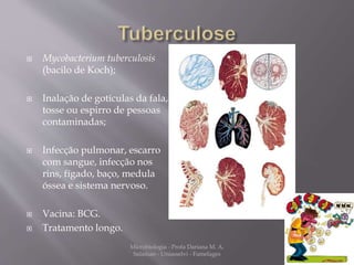  Mycobacterium tuberculosis 
(bacilo de Koch); 
 Inalação de gotículas da fala, 
tosse ou espirro de pessoas 
contaminadas; 
 Infecção pulmonar, escarro 
com sangue, infecção nos 
rins, fígado, baço, medula 
óssea e sistema nervoso. 
 Vacina: BCG. 
 Tratamento longo. 
Microbiologia - Profa Dariana M. A. 
Salaman - Uniasselvi - Famelages 
 