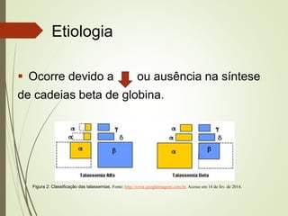Etiologia
 Ocorre devido a

ou ausência na síntese

de cadeias beta de globina.

Figura 2: Classificação das talassemias. Fonte: http://www.googleimagens.com.br. Acesso em 14 de fev. de 2014.

 