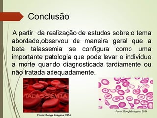 Conclusão
A partir da realização de estudos sobre o tema
abordado,observou de maneira geral que a
beta talassemia se configura como uma
importante patologia que pode levar o individuo
a morte quando diagnosticada tardiamente ou
não tratada adequadamente.

Fonte: Google Imagens, 2014
Fonte: Google Imagens, 2014

 
