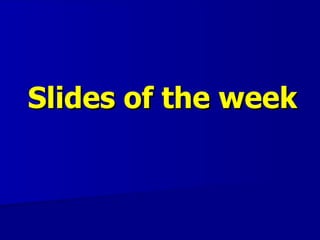 Slides of the week
 
