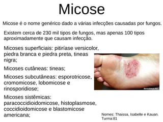 Micose
Micose é o nome genérico dado a várias infecções causadas por fungos.
Existem cerca de 230 mil tipos de fungos, mas apenas 100 tipos
aproximadamente que causam infecção.
Micoses superficiais: pitiríase versicolor,
piedra branca e piedra preta, tineas
nigra;
Micoses cutâneas: tineas;
Micoses subcutâneas: esporotricose,
cromomicose, lobomicose e
rinosporidiose;
Micoses sistêmicas:
paracoccidioidomicose, histoplasmose,
coccidioidomicose e blastomicose
americana; Nomes: Thaissa, Isabelle e Kauan.
Turma:81
 