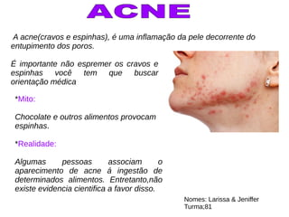A acne(cravos e espinhas), é uma inflamação da pele decorrente do
entupimento dos poros.
É importante não espremer os cravos e
espinhas você tem que buscar
orientação médica
*Mito:
Chocolate e outros alimentos provocam
espinhas.
*Realidade:
Algumas pessoas associam o
aparecimento de acne á ingestão de
determinados alimentos. Entretanto,não
existe evidencia cientifica a favor disso.
Nomes: Larissa & Jeniffer
Turma;81
 