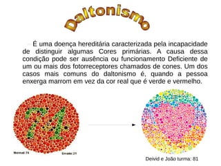 É uma doença hereditária caracterizada pela incapacidade
de distinguir algumas Cores primárias. A causa dessa
condição pode ser ausência ou funcionamento Deficiente de
um ou mais dos fotorreceptores chamados de cones. Um dos
casos mais comuns do daltonismo é, quando a pessoa
enxerga marrom em vez da cor real que é verde e vermelho.
Deivid e João turma: 81
 