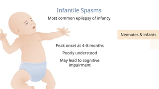 Neonates & infants
Peak onset at 4–8 months
Poorly understood
May lead to cognitive
impairment
Most common epilepsy of infancy
Infantile Spasms
 