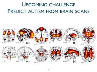 30
UPCOMING CHALLENGE	

PREDICT AUTISM FROM BRAIN SCANS
 