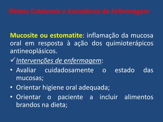Efeitos Colaterais e Assistência de Enfermagem
Mucosite ou estomatite: inflamação da mucosa
oral em resposta à ação dos quimioterápicos
antineoplásicos.
Intervenções de enfermagem:
• Avaliar cuidadosamente o estado das
mucosas;
• Orientar higiene oral adequada;
• Orientar o paciente a incluir alimentos
brandos na dieta;
 