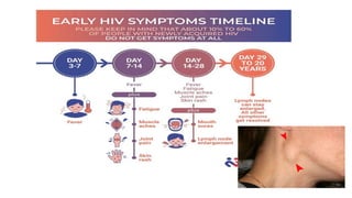 Slide Remaja dan penyakit disebabkan oleh pergaulan bebas AIDS | PPTX