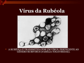 Vírus da Rubéola




   A RUBÉOLA É TRANSMITIDA POR UM VÍRUS, PERTECENTE AO
          GÊNERO RUBIVIRUS (FAMÍLIA TOGAVIRIDAE).
 