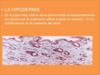 • LA HIPODERMIS
• Es la capa más interna de la piel formada fundamentalmente
  por grasa que el organismo utiliza cuando la necesita . En la
  adolescencia es la causante del acné .
 