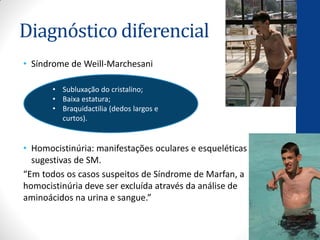 Diagnóstico diferencial
• Síndrome de Weill-Marchesani
• Homocistinúria: manifestações oculares e esqueléticas
sugestivas de SM.
“Em todos os casos suspeitos de Síndrome de Marfan, a
homocistinúria deve ser excluída através da análise de
aminoácidos na urina e sangue.”
• Subluxação do cristalino;
• Baixa estatura;
• Braquidactilia (dedos largos e
curtos).
 