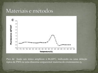 Pico de fusão um único amplicon à 86,68°C, indicando ou uma deleção
típica de PWS ou uma dissomia uniparental materna do cromossomo 15.
 