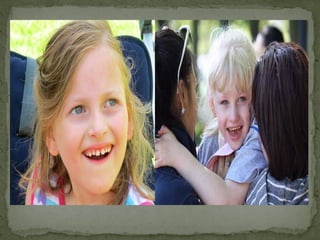 A síndrome de Angelman
foi descrita pela primeira
vez em 1965 com base nas
características de três
crianças:
 Severo retardo mental;
 Epilepsia;
 Deglutição atípica;
 Marcha atáxica;
 Microcefalia;
 Dificuldades na fala;
 Movimentos desconexos;
 Sorriso frequente;
 Excitabilidade sem
motivo;
 Deficiência intelectual
grave e alterações no sono.
 