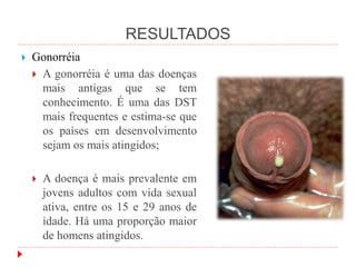 RESULTADOS
 Gonorréia
 A gonorréia é uma das doenças
mais antigas que se tem
conhecimento. É uma das DST
mais frequentes e estima-se que
os países em desenvolvimento
sejam os mais atingidos;
 A doença é mais prevalente em
jovens adultos com vida sexual
ativa, entre os 15 e 29 anos de
idade. Há uma proporção maior
de homens atingidos.
 