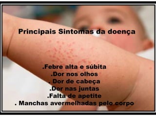 Principais Sintomas da doença 
.Febre alta e súbita 
.Dor nos olhos 
. Dor de cabeça 
.Dor nas juntas 
.Falta de apetite 
. Manchas avermelhadas pelo corpo 
 