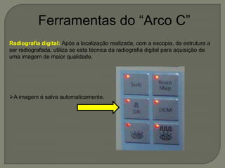 Ferramentas do “Arco C”
Radiografia digital: Após a localização realizada, com a escopia, da estrutura a
ser radiografada, utiliza se esta técnica da radiografia digital para aquisição de
uma imagem de maior qualidade.
A imagem é salva automaticamente.
 