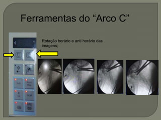 Ferramentas do “Arco C”
Rotação horário e anti horário das
imagens;
 