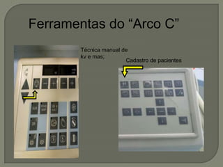 Ferramentas do “Arco C”
Técnica manual de
kv e mas;
Cadastro de pacientes
 