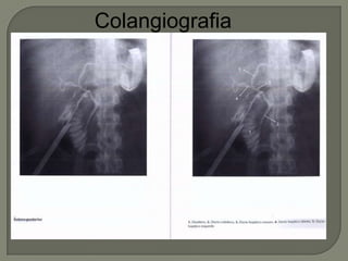 Colangiografia
 