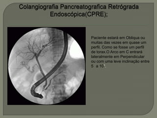 Paciente estará em Obliqua ou
muitas das vezes em quase um
perfil. Como se fosse um perfil
de torax.O Arco em C entrará
lateralmente em Perpendicular
ou com uma leve inclinação entre
5 a 10°.
 